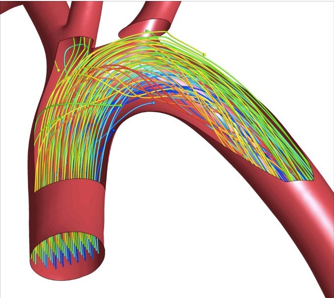 Aortic arch