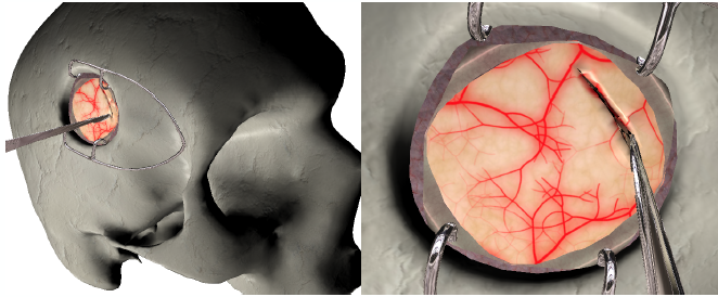 Real-time simulation of cutting