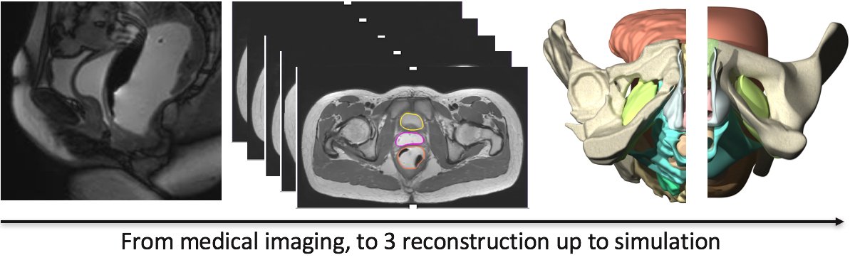 3D reconstruction to FE simulation